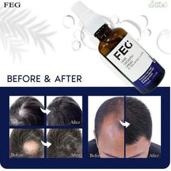 FEG Plus Hair Growth Spray (Original USA Imported)