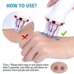 5 in 1 Blackhead Remover | Derma Suction | Rechargeable